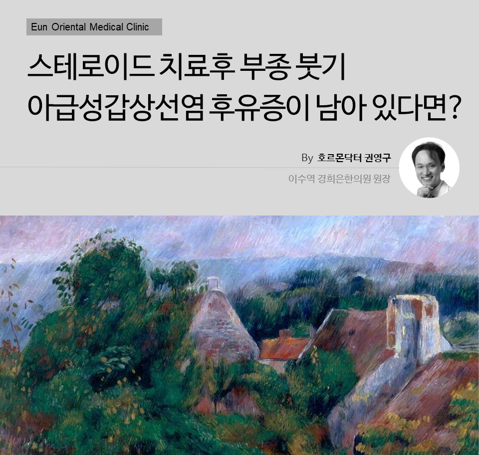 스테로이드 치료후 부종 붓기 아급성갑상선염 후유증이 남아 있다면