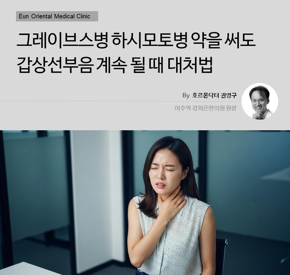 그레이브스병 하시모토병 약을 써도 갑상선부음 계속될 때 대처법