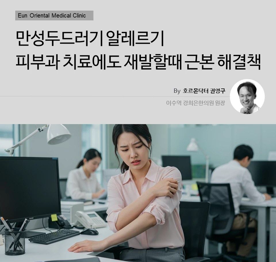 동작구 사당동 이수역에서 만성두드러기 알레르기 피부과 치료에도 재발할때 근본 해결책